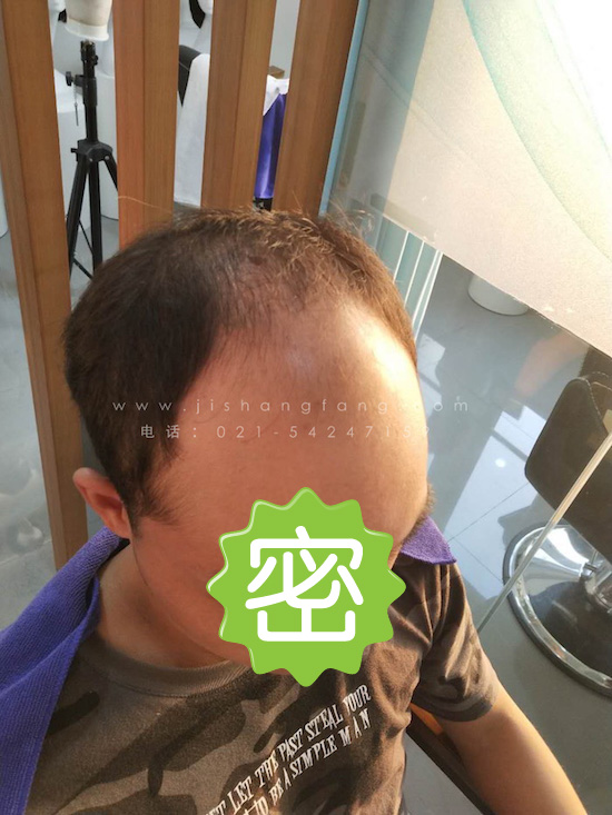 10.1СLټo һλǞ郺ӽKҴҎӁċ4