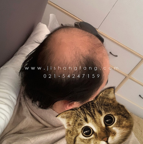 ҂J   oゃõwͷ2